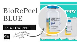 BioRePeel a 35 TCA Peel for Aestheticians Safe all year for all skin types [upl. by Tengler]