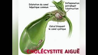 Anatomie Pathologique  Bases élémentaires [upl. by Eednas]