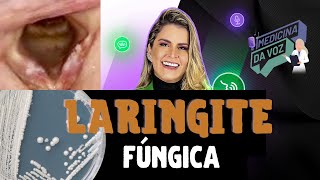 Laringite fúngica [upl. by Penny814]