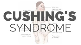 What is Cushing Syndrome  pathology symptoms causes diagnosis treatment [upl. by Galven492]