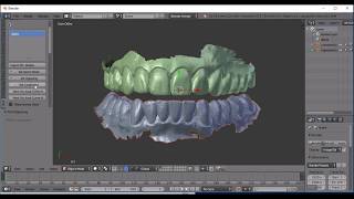 Flat Plane Occlusal Splint Workflow [upl. by Webb]