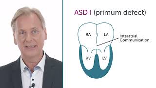 What is a primum defectASD I [upl. by Eetak]