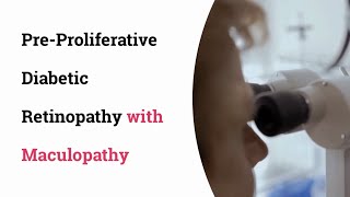 Preproliferative diabetic retinopathy with Maculopathy [upl. by Therese840]