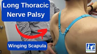 Long Thoracic Nerve Palsy Winging Scapula [upl. by Nylazor]