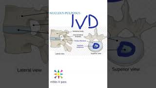 Anatomy Thorax 218 Nucleus Pulposus InterVertebral disc prolapse viva [upl. by Murdoch]