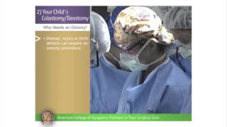 Pediatric ColostomyIleostomy Your Childs ColostomyIleostomy [upl. by Hairacaz224]