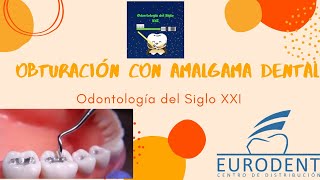 Obturación con amalgama dental [upl. by Solnit474]