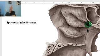 Anatomy of head and neck module in Arabic 33 Sphenopalatine ganglion  by Dr Wahdan [upl. by Mattheus]