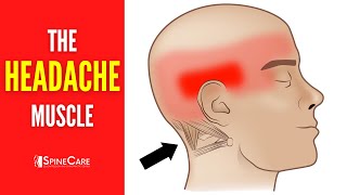 The Headache Muscle How to Release It for INSTANT RELIEF [upl. by Orihakat]