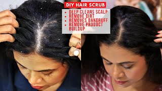 DIY Scalp Scrub  Exfoliate Your Hair  Remove Dead Skin Dirt amp Dandruff  Body Cupid Aloe Vera Gel [upl. by Levinson]