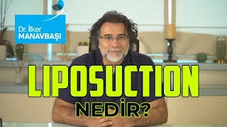 Liposuction  Yağ Aldırma  Nedir  Nasıl Yapılır  Ne Amaçla Kullanılır [upl. by Rehotsirk]