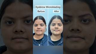 What is Microblading eyebrows  Eyebrow tattoo microblading Microblading eyebrows before and after [upl. by Allix]