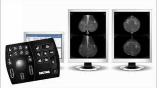 Sectra Breast Imaging RISPACS [upl. by Nodnnarb]