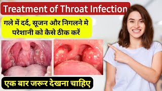 Pharyngitis throat infection treatment in hindi  गले में खराश दर्द और सूजन होने पर क्या करें [upl. by Lah929]