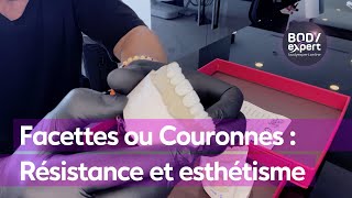 SOINS DENTAIRES  🦷Facettes ou Couronnes  Comment allier résistance et esthétisme  BODYEXPERT [upl. by Yddet827]