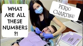 Why Are My Gums Numbered At The Dentist Dental Hygienist Explains Perio Charting and Probing [upl. by Anirbed]