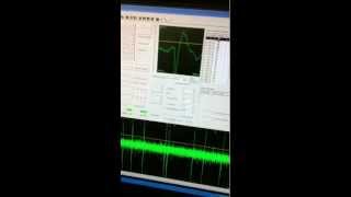 Electrophysiological Recording Example [upl. by Bee532]