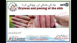 جلد کی خشکی اور چھلکے اترنا۔Dryness and peeling of the skin [upl. by Loring]