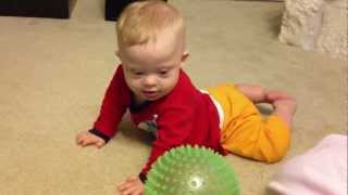 Baby with Down syndrome playing with parents and laughing [upl. by Jonas]