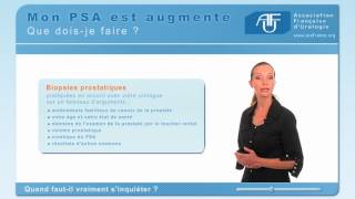 PSA  Mon PSA est augmenté que doisje faire [upl. by Bennet]