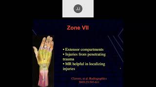 MRI of the Wrist Part 8  Wrist Tendons [upl. by Pearson64]