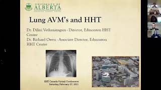 Lung Arteriovenous Malformations AVMs and Hereditary Hemorrhagic Telangiectasia HHT [upl. by Hoshi]