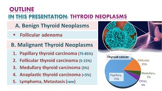 Thyroid neoplasmsTumors  شرح محاضرة [upl. by Nesiaj68]