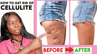 How to get rid of CELLULITE on your THIGHS LEGS amp BUTT Home Remedies Workout  Creams amp more [upl. by Cahilly]