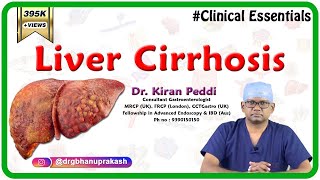 Liver Cirrhosis Clinical essentials  Dr Kiran Peddi MRCPUK FRCPLondon CCTGastro [upl. by Aiekram]