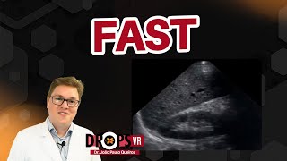 FAST FOCUSED ASSESSMENT BY SONOGRAPHY IN TRAUMA I VOCÊ RADIOLOGISTA [upl. by Rimisac]