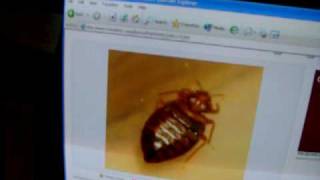 bed bug control bedbug infestation treatment preparation kill egg bite feeding eat party song [upl. by Ludba]