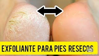 EXFOLIANTE CASERO PARA LOS PIES RESECOS Y AGRIETADOS [upl. by Maltzman]