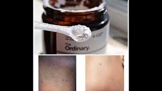 How to use the Ordinary LAscorbic Acid Powder For Bright Glowing Skin 2019 [upl. by Aromat]