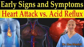 Identifying Heart Attack vs Acid Reflux GERD Early Warning Signs amp Symptoms  Dr Mandell DC [upl. by Evander]