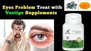 Vestige eye support capsules benefits in hindi  how to use vestige eye support capsules [upl. by Drona267]