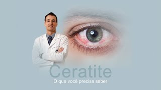 CERATITE  O QUE VOCÊ PRECISA SABER [upl. by Marela]