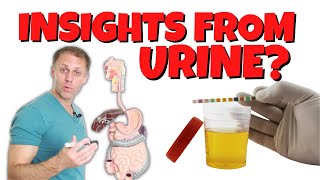 What Can You Learn From Your Urine [upl. by Eineeuq248]