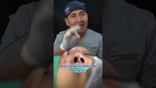 Proceso complejo de rinoseptoplastia [upl. by Filler]