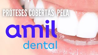 Quais Próteses são cobertas pela Amil Dental E170E90 e E60 [upl. by Pompea]