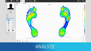 Create Custom Orthotics with a Digital Workflow  Materialise Phits Suite [upl. by Parthena]