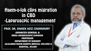 Hemolok clips migration in CBD Laparoscopic management [upl. by Folly638]