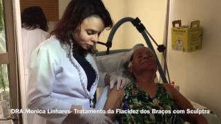 Tratamento para Flacidez dos Braços com Sculptra Dermatologia e Estética [upl. by Asilam398]