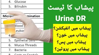 تحليل كريات الدم البيضاء في البول  Analysis of leukocytes in urine [upl. by Ymeraj]