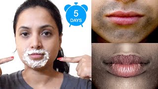 ಬಾಯಿ ಸುತ್ತಾ ಕಪ್ಪಾಗಿದ್ದರೆ ಇಲ್ಲಿದೆ ಮನೆ ಮದ್ದು  Remove Dark Spots Black Patches Around Mouth In 5 Days [upl. by Pietra]