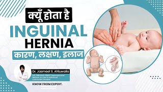 What is Inguinal Hernia Causes and Symptoms Treatment  बच्चों में अंडकोष हर्निया  लक्षण कारण [upl. by Ihcehcu3]