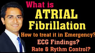 ATRIAL FIBRILLATION AFIB TREATMENT ECG INTERPRETATION PATHOPHYSIOLOGY AFIB MANAGEMENT LECTURE [upl. by Glialentn359]