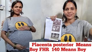 Placenta Posterior Means Boy FHR 140 Means Boy 🤰 [upl. by Pappas]