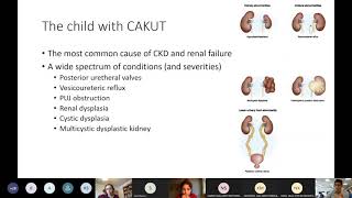 MRCPCH Clinical Exam Teaching  Renal [upl. by Marwin128]