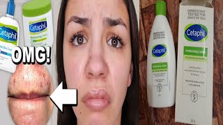 quotCetaphil Moisturizing Lotion Review  For Dry Oily amp Sensitive Skin  Best Skincare Productquot [upl. by Esilehc547]