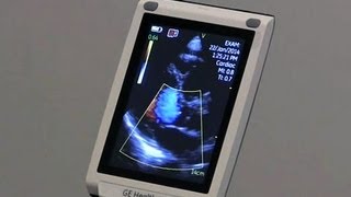 Handheld ultrasound may replace the stethoscope [upl. by Dyche]